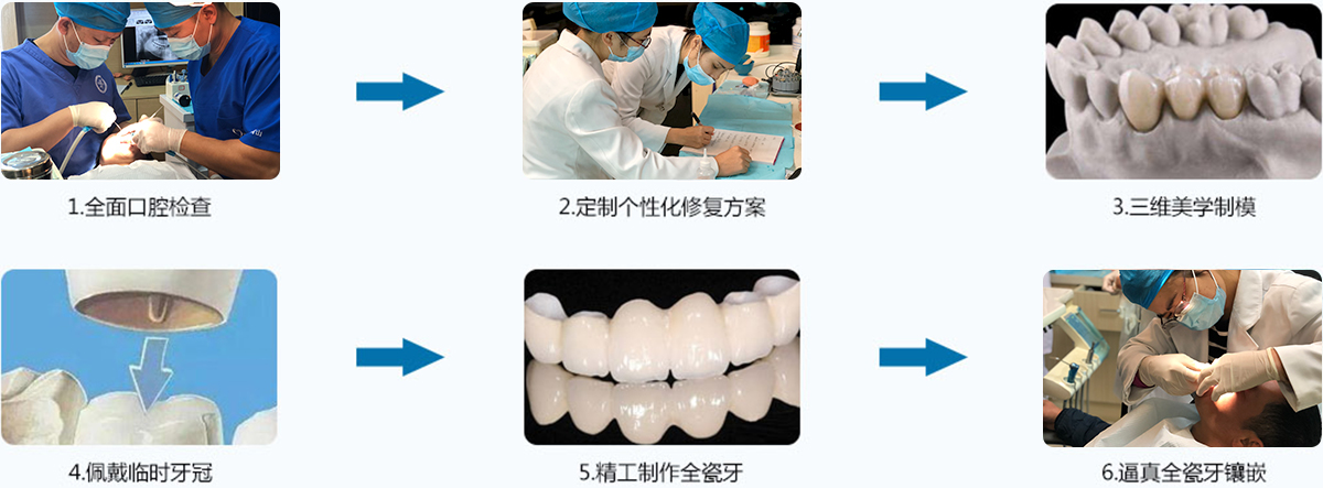 牙齒修復流程
